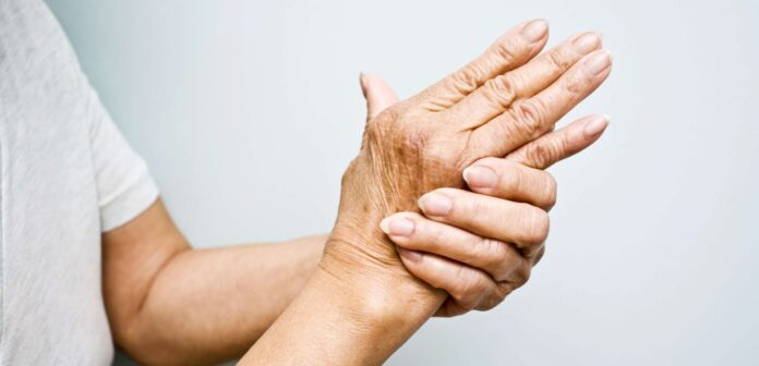 how to manage arthritis properly