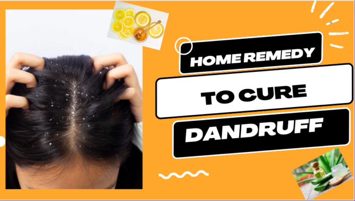 how to cure dandruff at home